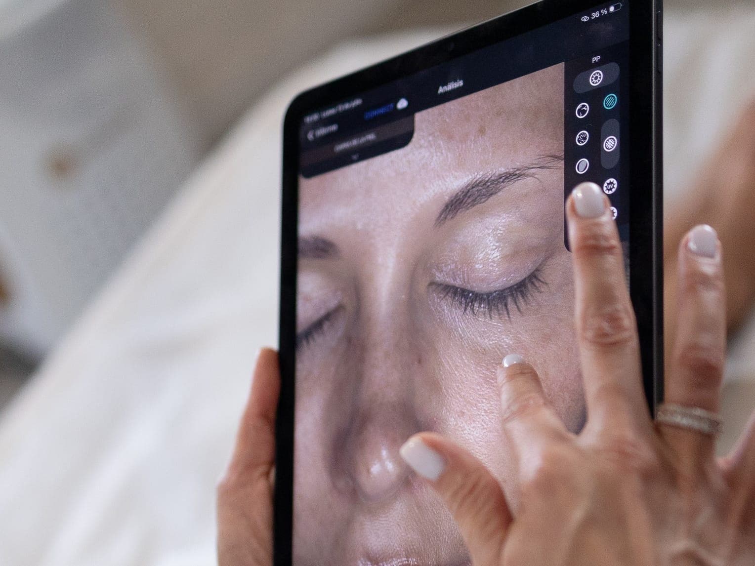 Análisis de la piel en la tableta, con las manchas y la textura a la vista