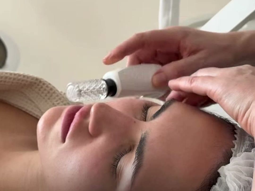 La pieza facial de Endosphères, con microesferas, sobre la frente de una clienta relajada