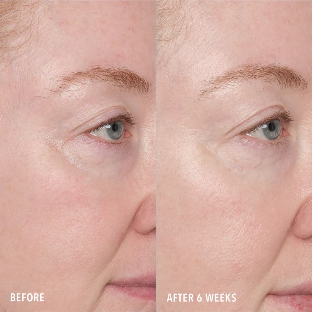 Resurface and Repair Peptide Pads — 3