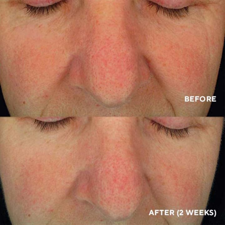 Soothing Serum — 4